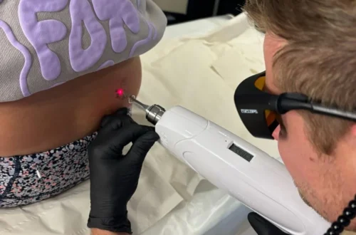 Are Online Laser Tattoo Removal Courses Enough