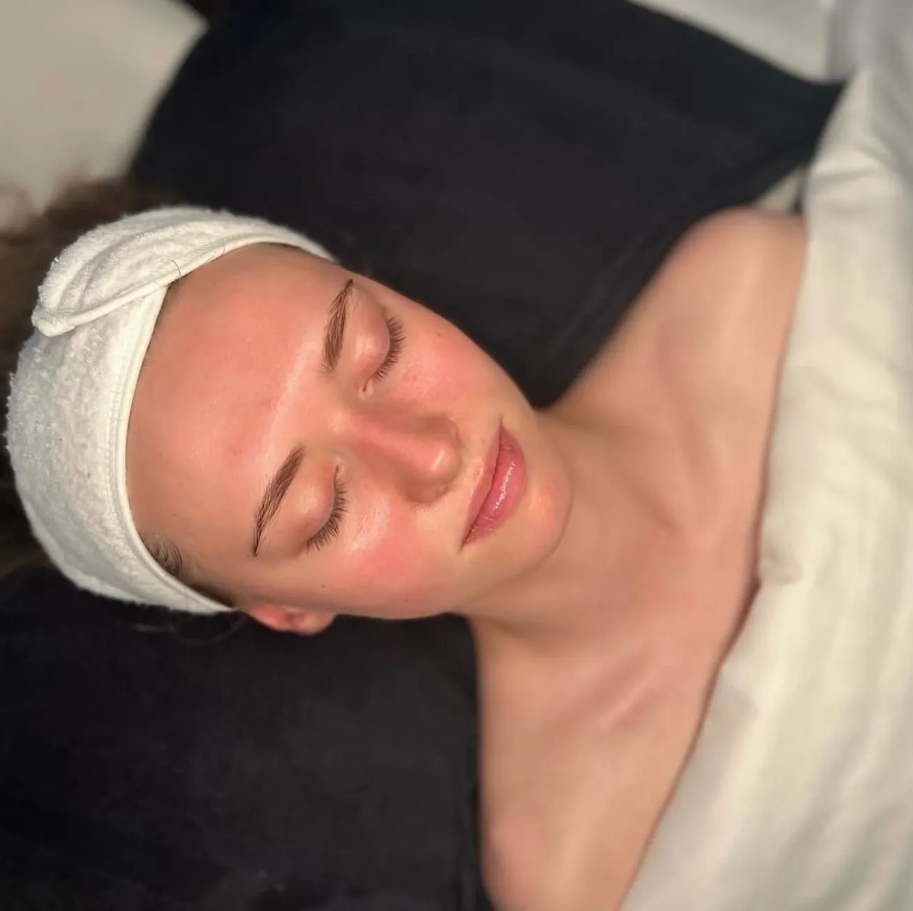 Brisbane’s Climate and Your Skin