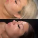 When should you start getting facials